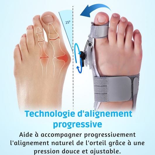 Align'Orteil™